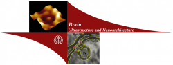 თავის ტვინის ულტრა– და ნანოარქიტექტონიკის ლაბორატორია